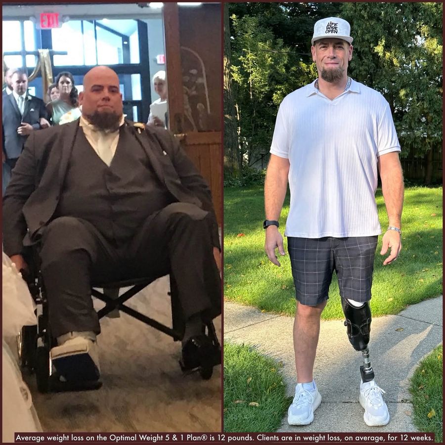 Before-and-after men's weight loss transformation photo, community member 11