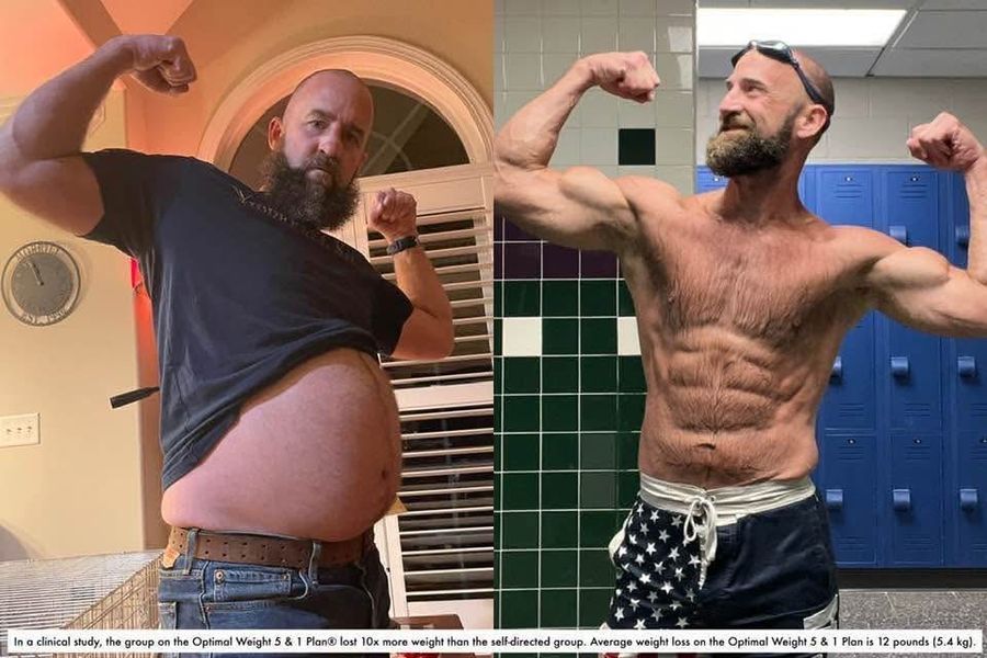 Before-and-after men's weight loss transformation photo, community member 13